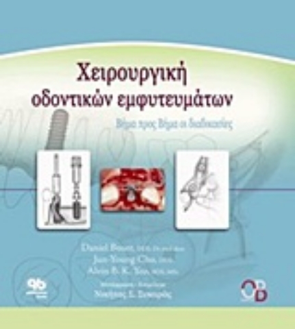 Εικόνα της Χειρουργική οδοντικών εμφυτευμάτων